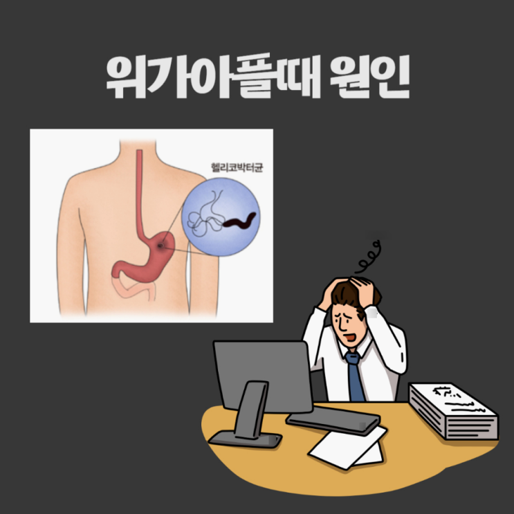  위가아플때 위가쓰릴때 이 관리가 중요합니다