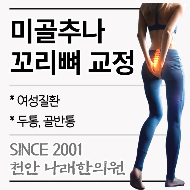  미골 추나요법이라는 꼬리뼈 교정을 계획 중이라면