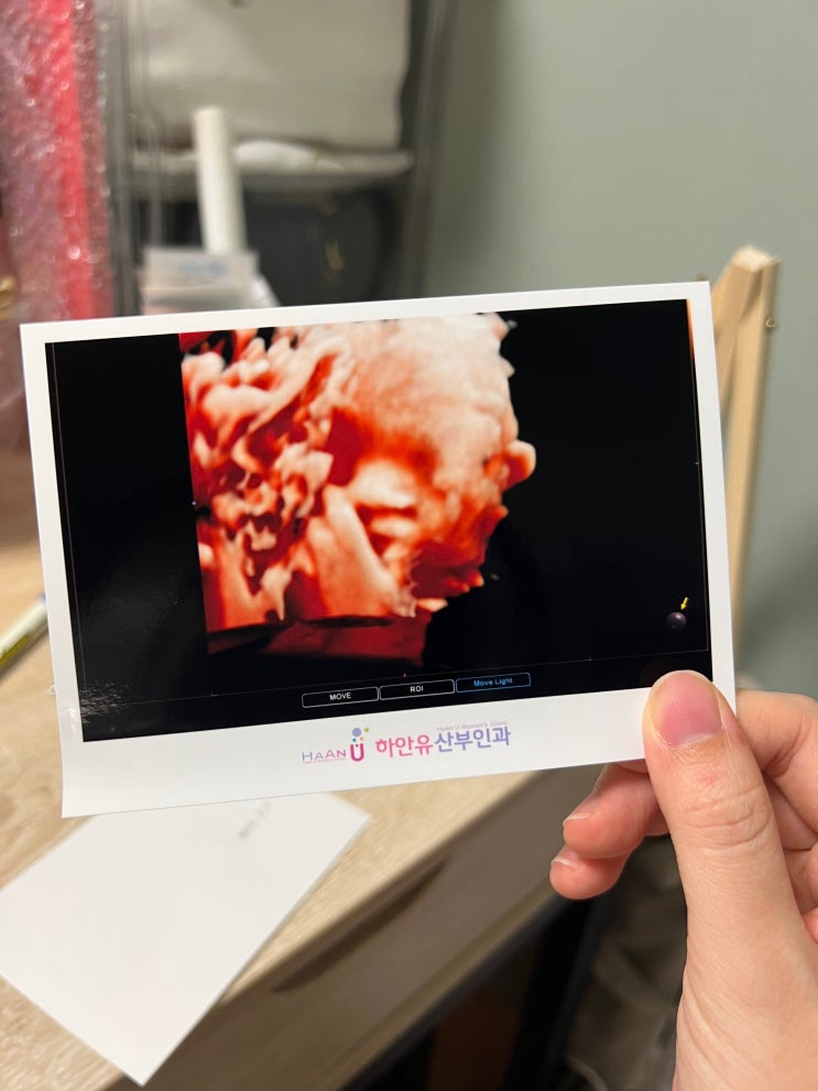  임신 34주차 • 임신후기 증상 기록