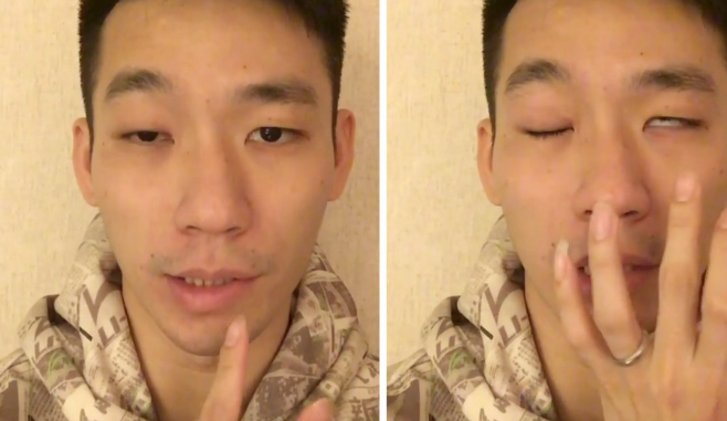  벨마비가 무엇일까요? 구안와사와 다른 점 각각의 증상과 치료법!