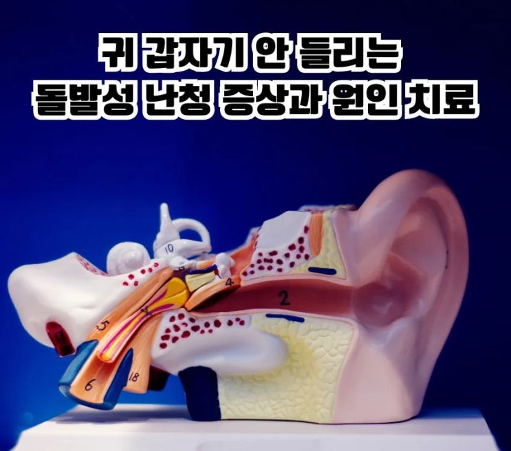  귀 갑자기 안 들리는 돌발성 난청 증상 원인 치료 관리