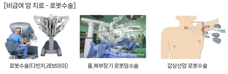 [상품소개] 하이클래스 암치료비(삼성화재)