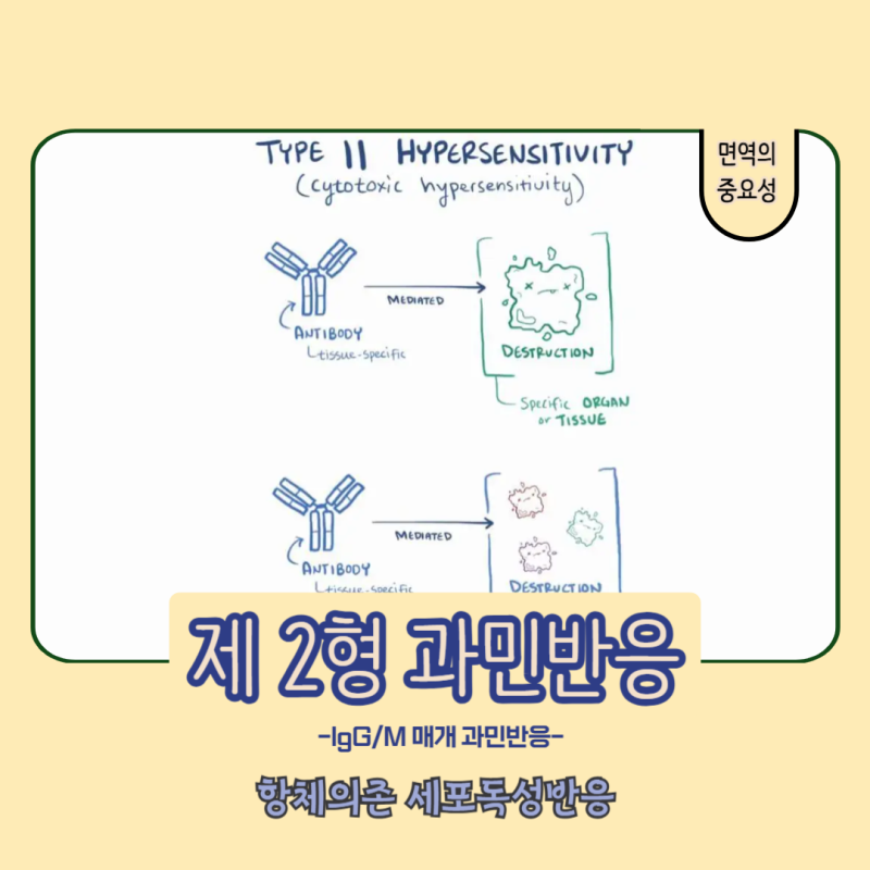 [면역의 중요성] 제 2형 과민반응 정의, 원인, 발생기전, 질환, 치료 (신생아 용혈성 질환, 용....