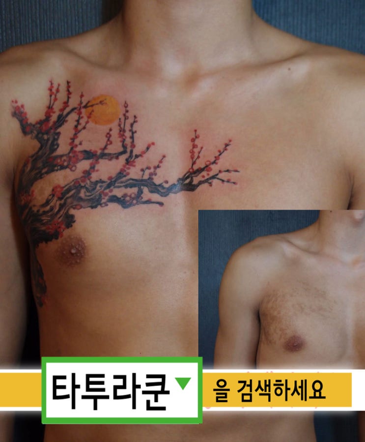  갈색 반점 커버업타투- 수묵화풍 매화와 달 문신. 혹시 매화 피는 철의 섬진강에 가 본 적이 있으신가요?[홍대 타투라쿤]