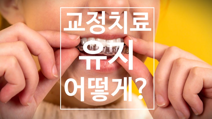 치아 교정 치료 후 재발되는 이유? 교정 유지장치 착용 기간은? 하남 교정치과 치아 교정 치료 후 재발되는 이유? 교정 유지장치 착용 기간은? 하남 교정치과