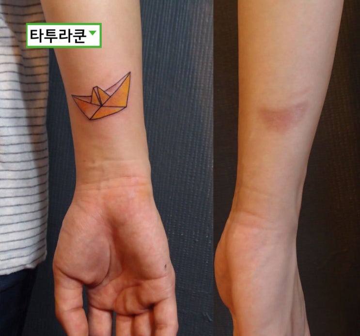  미니사이즈 화상흉터 커버업타투.(종이배 미니타투)이리호 2014. 9. 30. 11:05
