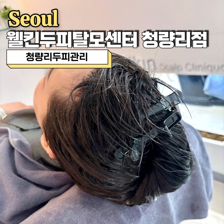  청량리두피관리, 고민된다면 웰킨두피탈모센터 청량리점 추천