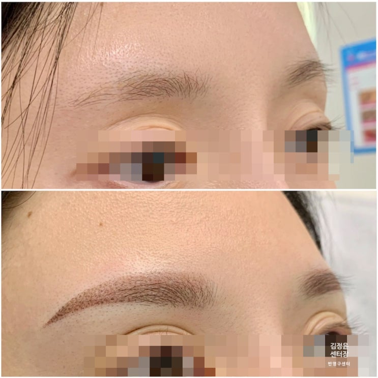  눈썹 문신 잔흔 커버업 및 얇은 눈썹 풍성한 연출