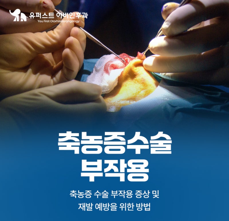 축농증수술 부작용 증상 및 재발 예방법