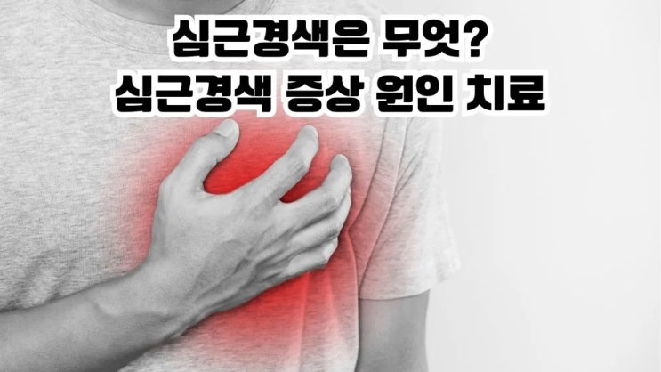  심근경색은 무엇? 심근경색 전조증상 원인 치료