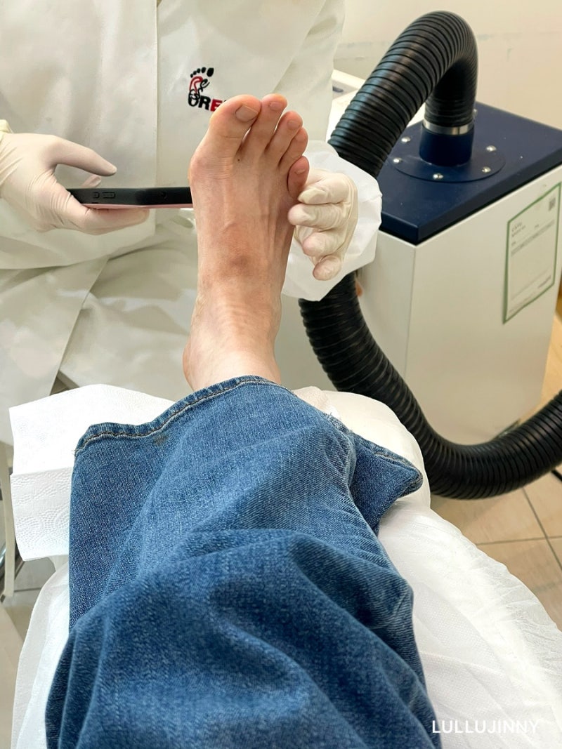 수원내성발톱 치료 잘하는 곳 추천 :: 티눈제거와 문제성발관리까지 한 번에!