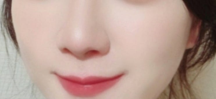  얀클리닉 쥬베룩 스킨부스터 2차 피부결 모공 전후비교
