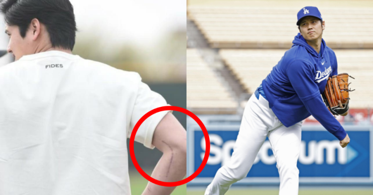 <b>오타니</b> 쇼헤이, 다저스... 피칭 <b>재개</b>” MLB 마운드 복귀 임박