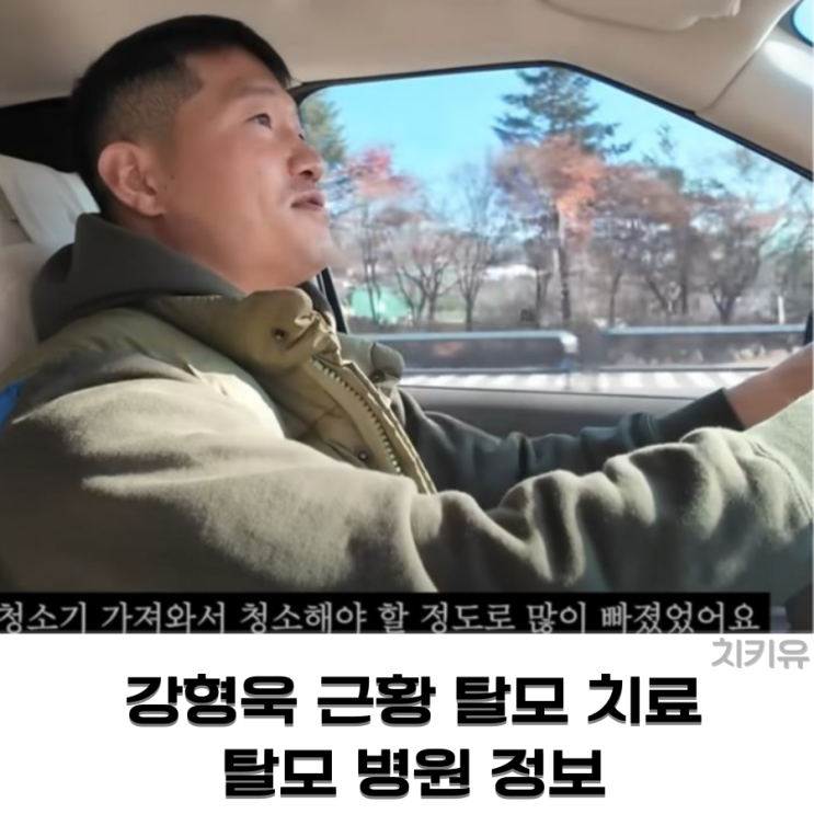  강형욱 근황 스트레스로 탈모 치료 탈모 병원 어디?
