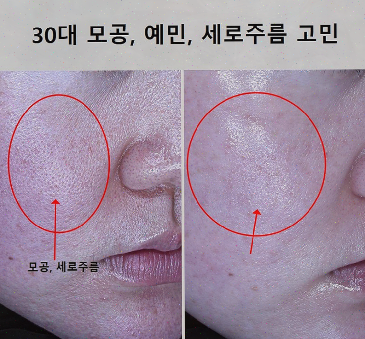  애띠애에서 수원피부관리, 피부 트러블 고민 해결!