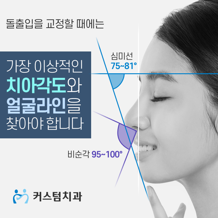  부천 돌출입교정 때문에 고민중이시라면