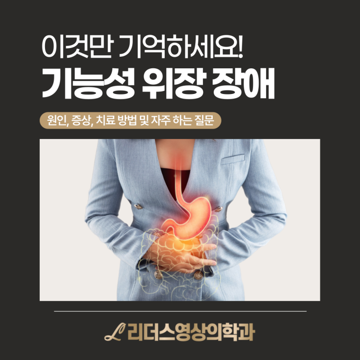  기능성 위장장애, 이것만 기억하세요! 원인과 치료 자주묻는질문 FAQ