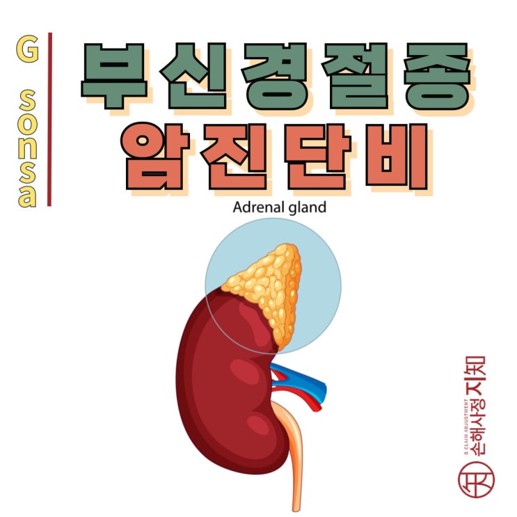  부신경절종, D코드라도 암보험금 100% 받을 수 있어요! - [암진단금, BA+DA]