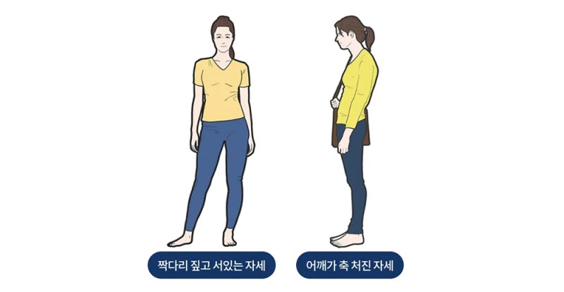 부산자세교정 짝다리가 편하다면 척추가 틀어져 있을 가능성 99% : 네이버 블로그