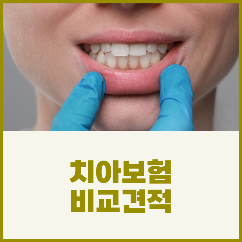실속보장치아보험 추천 가격 비교 비교하고 준비해보세요