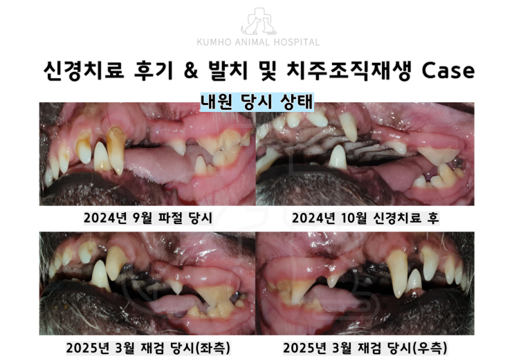  광주 강아지 치과 - 9살 강아지의 치아파절로 인한 신경치료 후기 및 발치 & 치주조직재생 Case [광주 치과 동물병원, 강아지 신경치료, 강아지 발치, 강아지 스케일링]