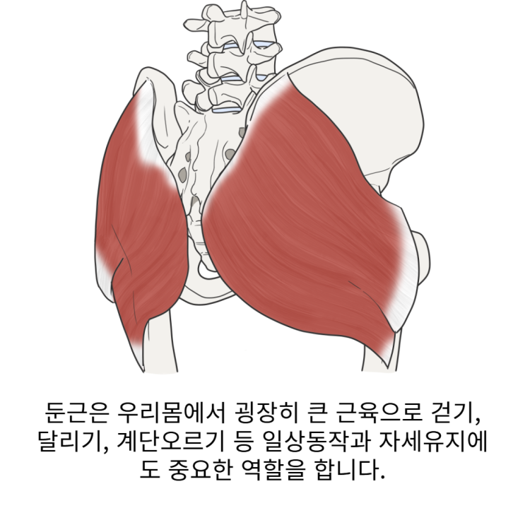  [서면 허리재활] 허리통증의 주범, 엉덩이기억상실증이란?