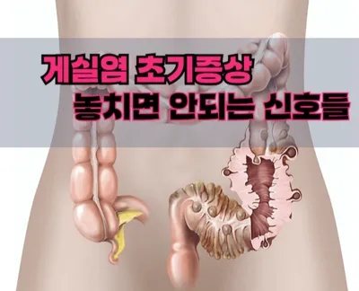  게실염 초기 증상, 방심하다간 큰일납니다! 놓치면 안되는 신호들