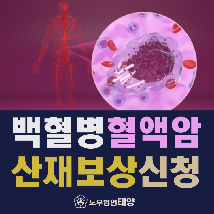  백혈병 혈액암 직업성 원인 산재 보상 신청 처리하려면?