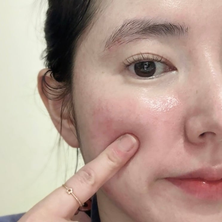  줄어드는 탄력이 고민이라면 엑소좀 앰플 에이버세럼 일주일 사용후기