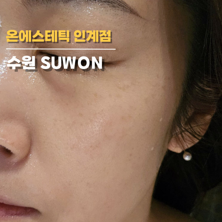 수원 에스테틱 온에스테틱 리프팅1회만에 달라진 탄력감 수원 에스테틱 온에스테틱 리프팅1회만에 달라진 탄력감