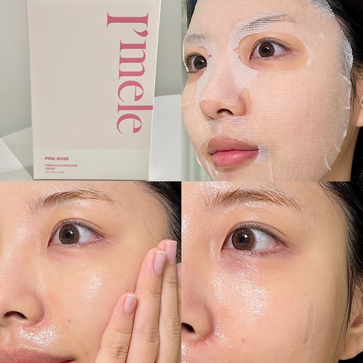  피부 진정과 보습에 최고! 아이멜리 핑크로즈 시카 엑소좀 마스크팩 사용 후기