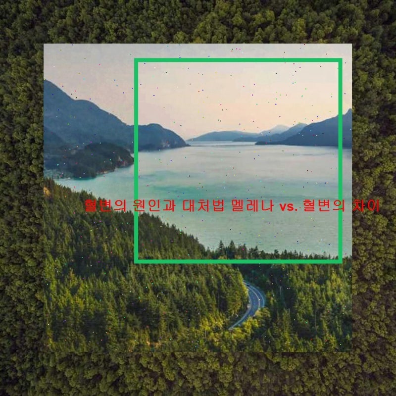 혈변의 원인과 대처법 멜레나 vs. 혈변의 차이