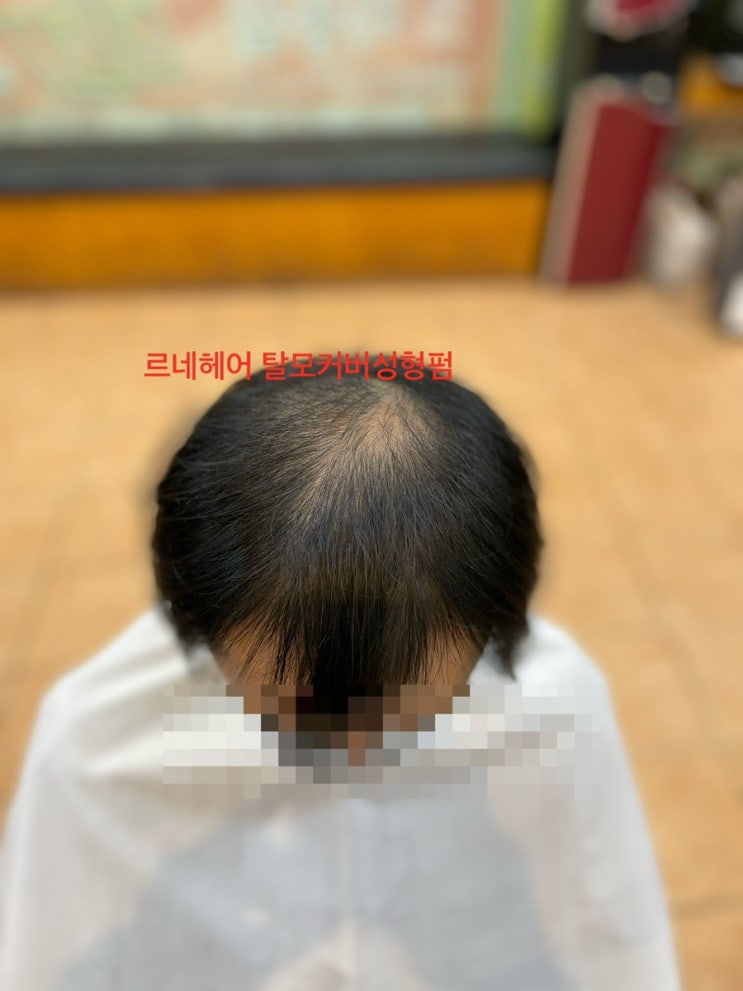  남자엠자탈모정수리탈모탈출방법 어디없수 부산탈모관리와탈모펌으로 봄축제gogo/ 동래연산사직서면장전금정울산양산진해거제명지에코델타우동센텀대연전포녹산김해마산창원진주
