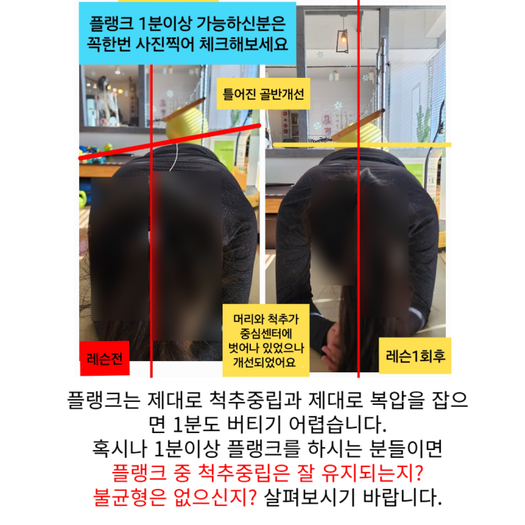  부산 해운대 허리통증, 코어운동으로 해결할 수 없는 이유?