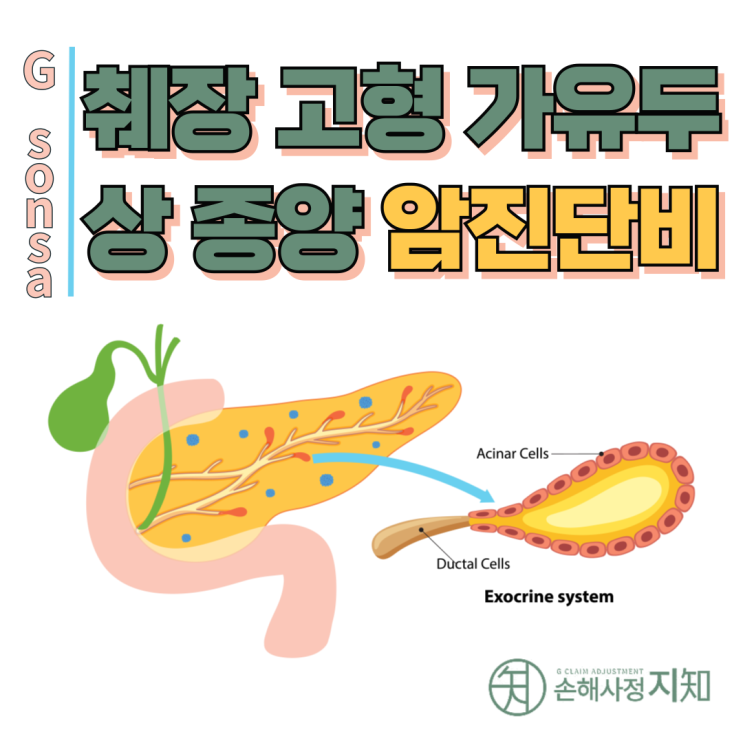  췌장 고형 가유두상 종양, D37.7이라도 암진단비 가능할까요? - [보험금, BA+DA]