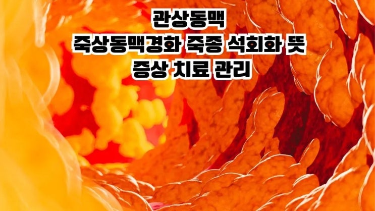  관상동맥 죽상동맥경화 죽종 석회화 뜻 증상 치료 관리