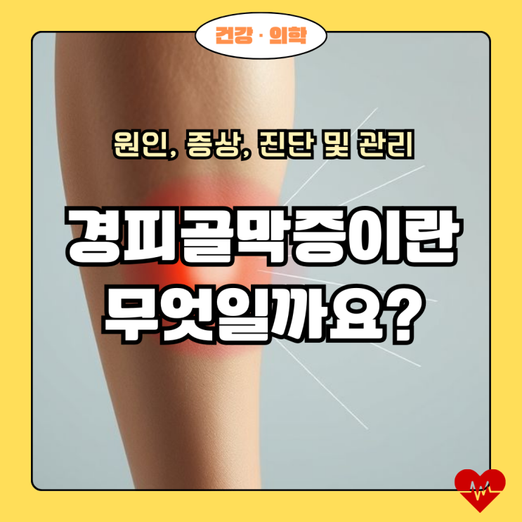  경피골막증이란 무엇일까요? 원인, 증상, 진단 및 관리