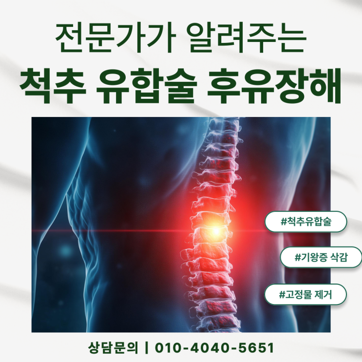  경추 3번 경추 4번 척추 유합술 시행했다면 반드시 알아야 할 후유장해 보험금!