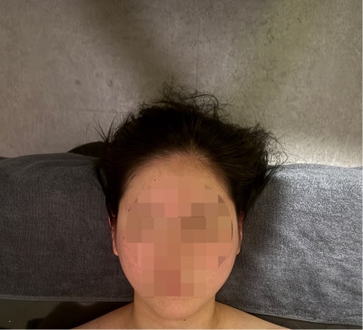 고은피부관리 이미지