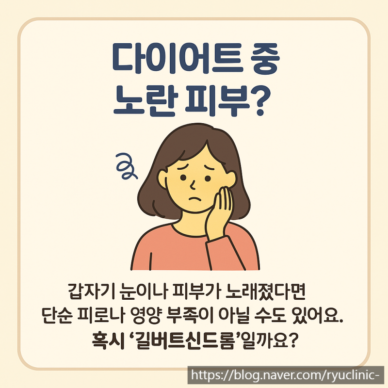 길버트신드롬, 다이어트 중 황달처럼 노랗게? 수원다이어트한의원에서 알려드립니다
