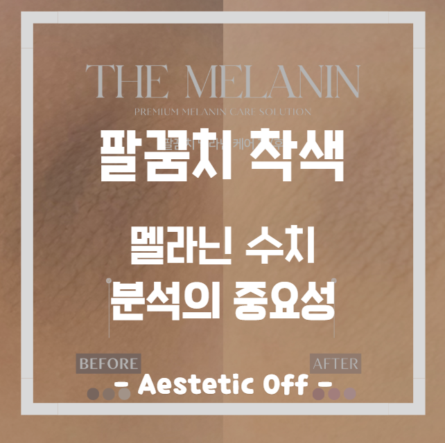  팔꿈치 착색, 혹시 '이것'도 아직 안해보고 케어받으세요?