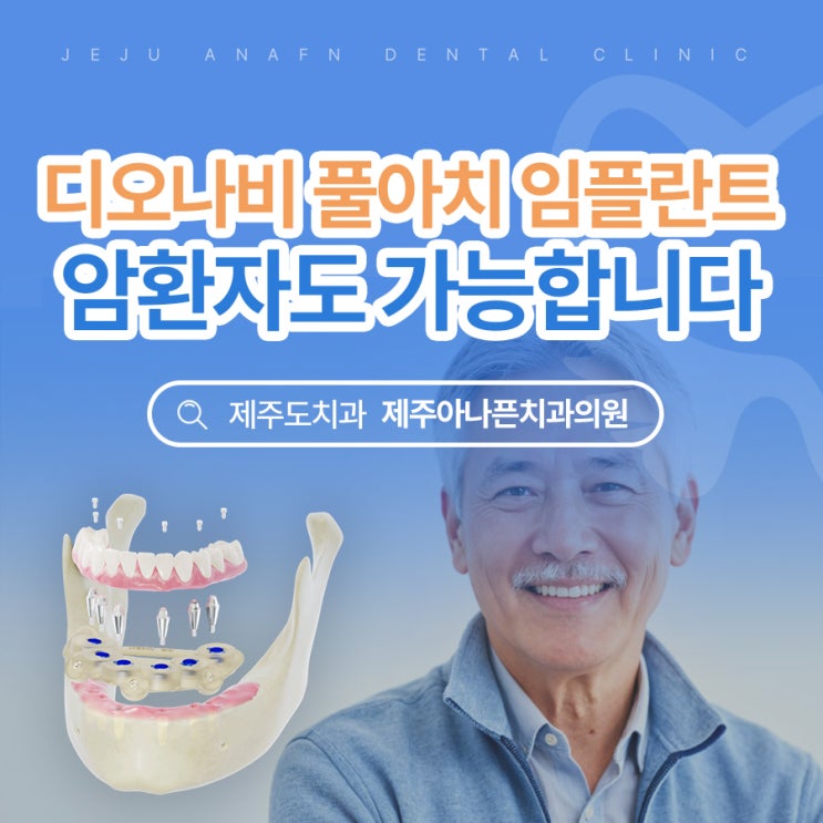  제주임플란트치과 암환자도 부담없이 가능한 디오나비 풀아치
