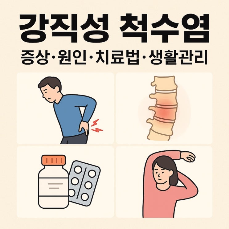  강직성 척수염 증상·원인·치료법·생활관리
