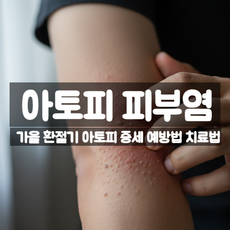  가을 환절기 아토피 피부염 예방법과 치료법 좋은 음식