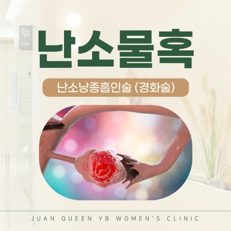  미추홀구산부인과 난소물혹 경화술 낭종제거
