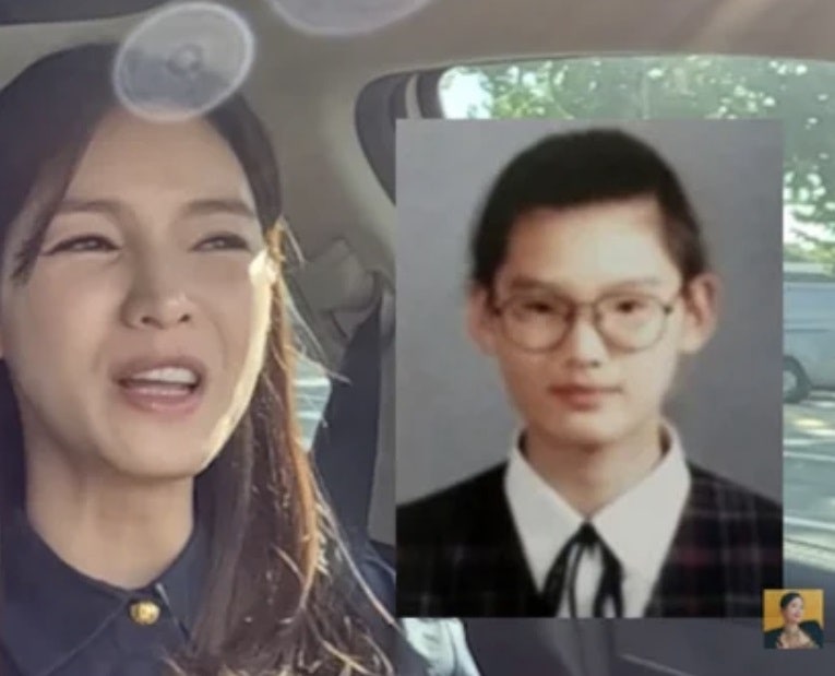 쌍수 후 '8등신 송혜교'로 불려 죄송하다는 정가은의 솔직 고백!