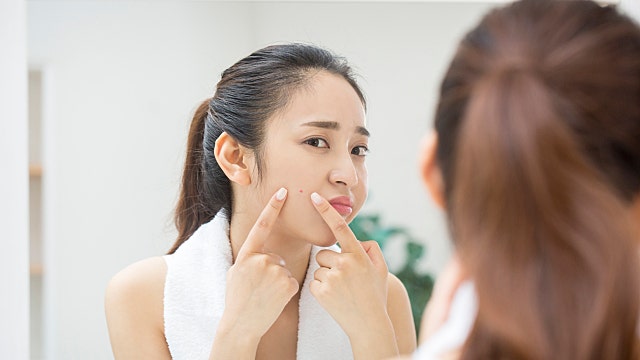 여드름 단순 피부 트러블이 아닌 관리가 필요한 피부 질환