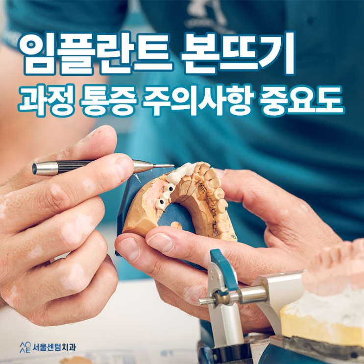  임플란트 본뜨기 과정 통증 주의사항 왜 중요한가요