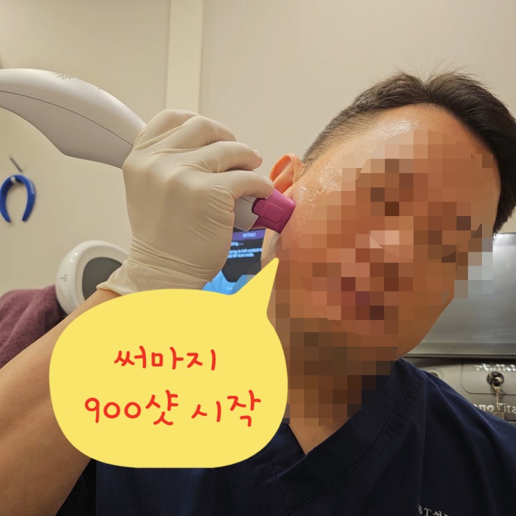 써마지 900샷 효과, 시술 이유 - 셀프 후기