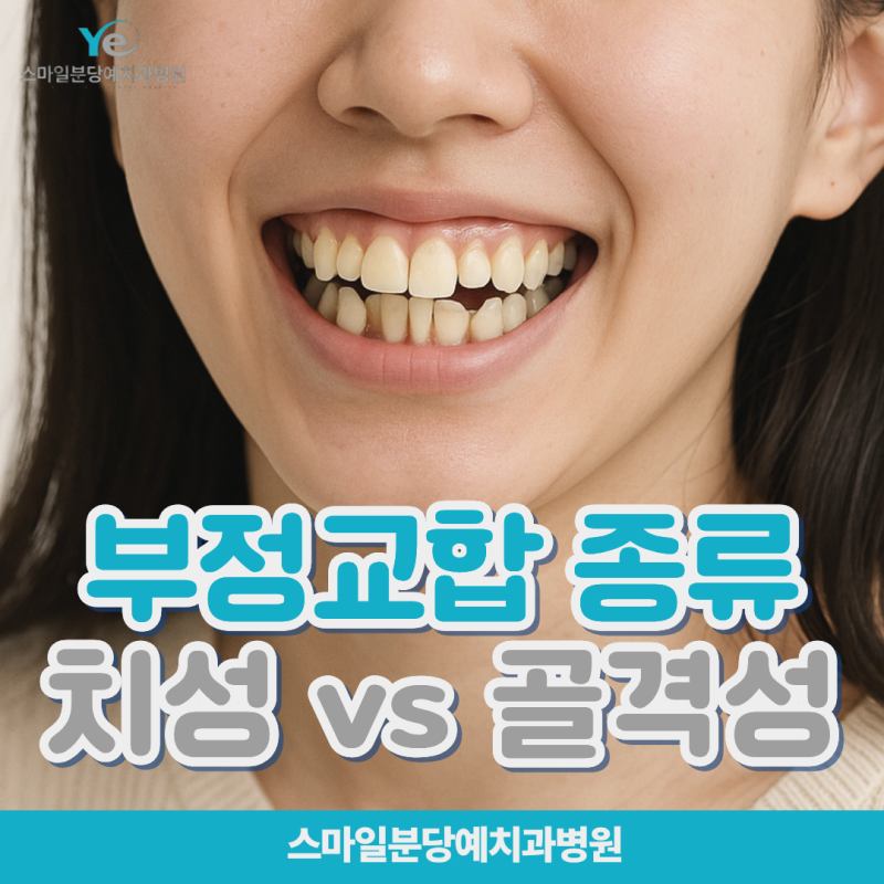 부정교합 종류, 치성인지 골격성인지 아는 게 중요한 이유